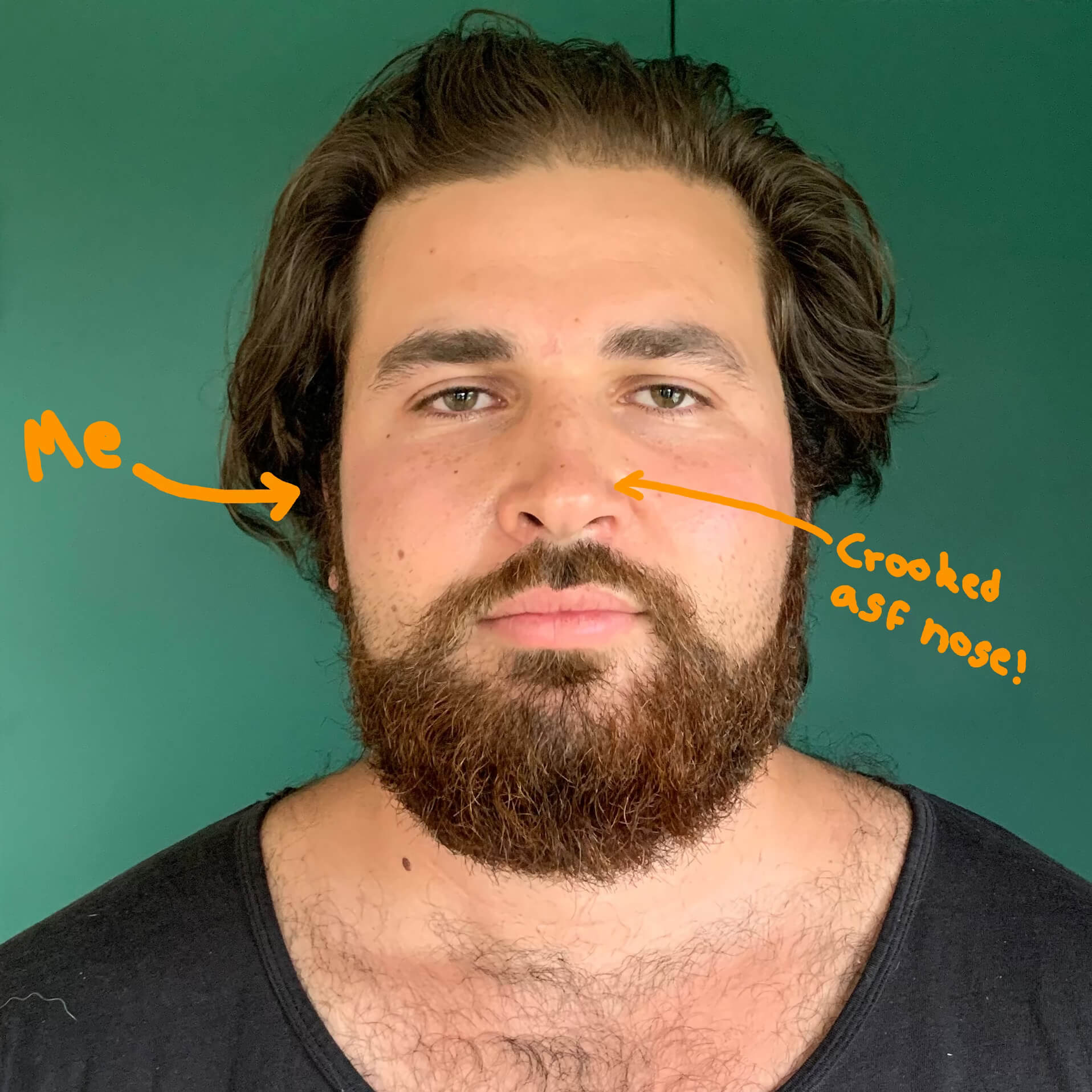 An old photo of BREATHMODE founder, Jozef Wright, before he discovered nasal strips and suffered from unrestful sleep