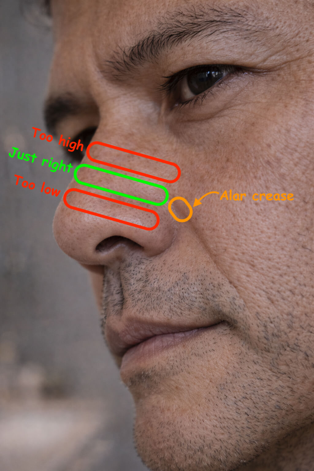 A mans face with a diagram showing the perfect placement and positioning for a BREATHMODE nasal strip to be applied